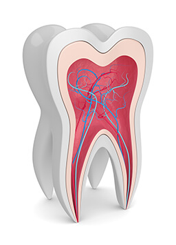 Wurzelbehandelter Zahn